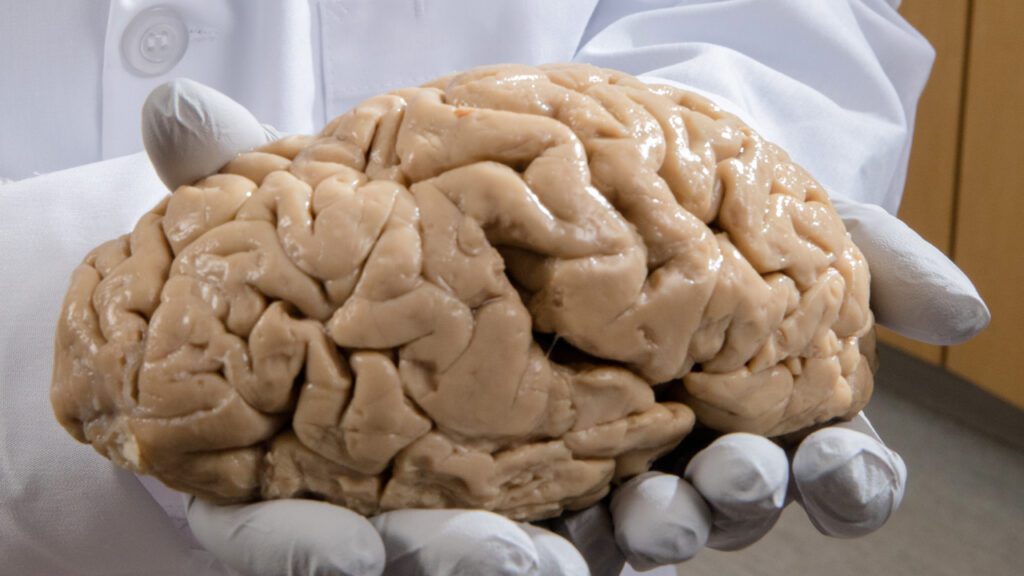 World Brain Day 2023: Unite for Neurological Health