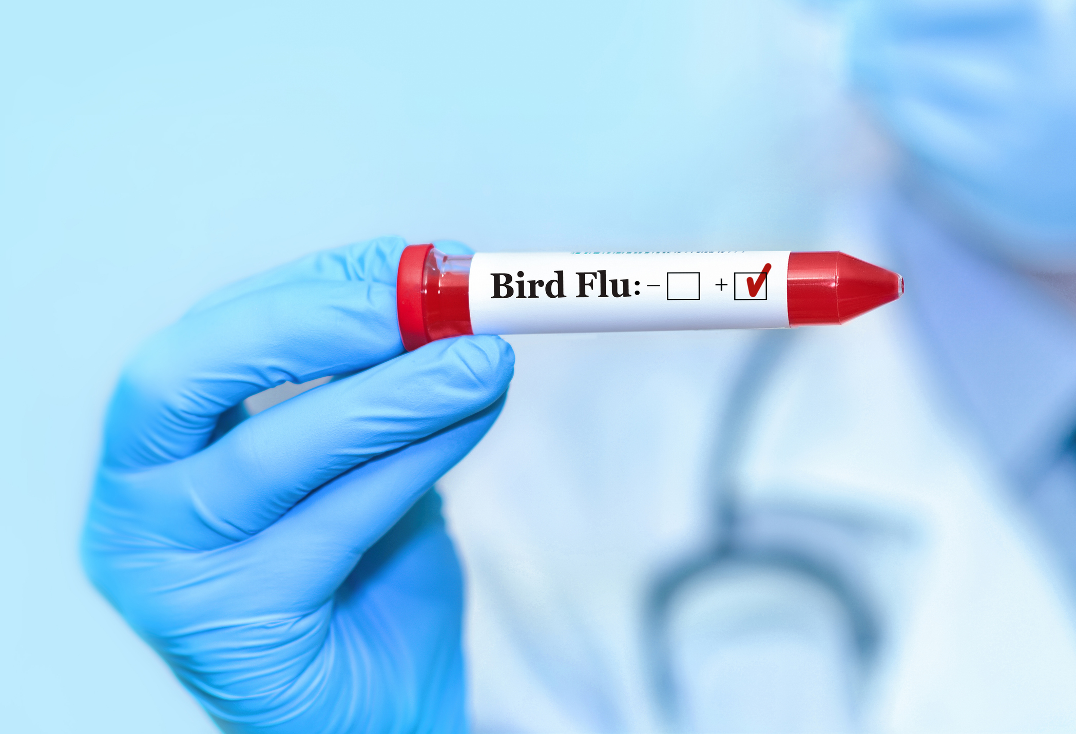 Human-to-Human Transmission Concerns as Californian Child Suspected of Contracting Avian Flu